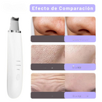 Limpiador facial  Ultrasónico MultiPeel Power