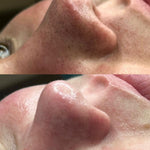 Limpiador facial  Ultrasónico MultiPeel Power