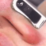 Limpiador facial  Ultrasónico MultiPeel Power